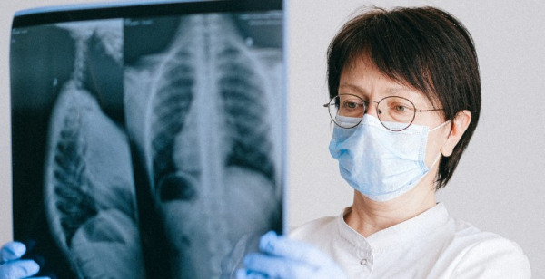 Cancro do pulmão: SPP pretende criação de programa nacional de rastreio