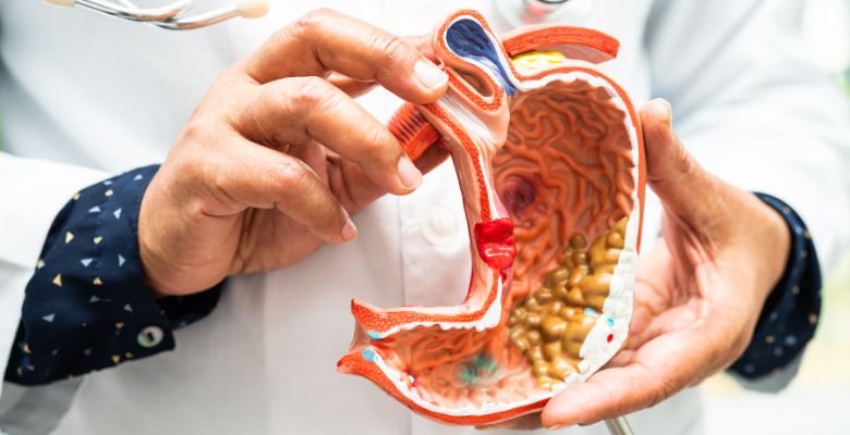 Investigadores descobrem que gordura favorece progressão do cancro do estômago